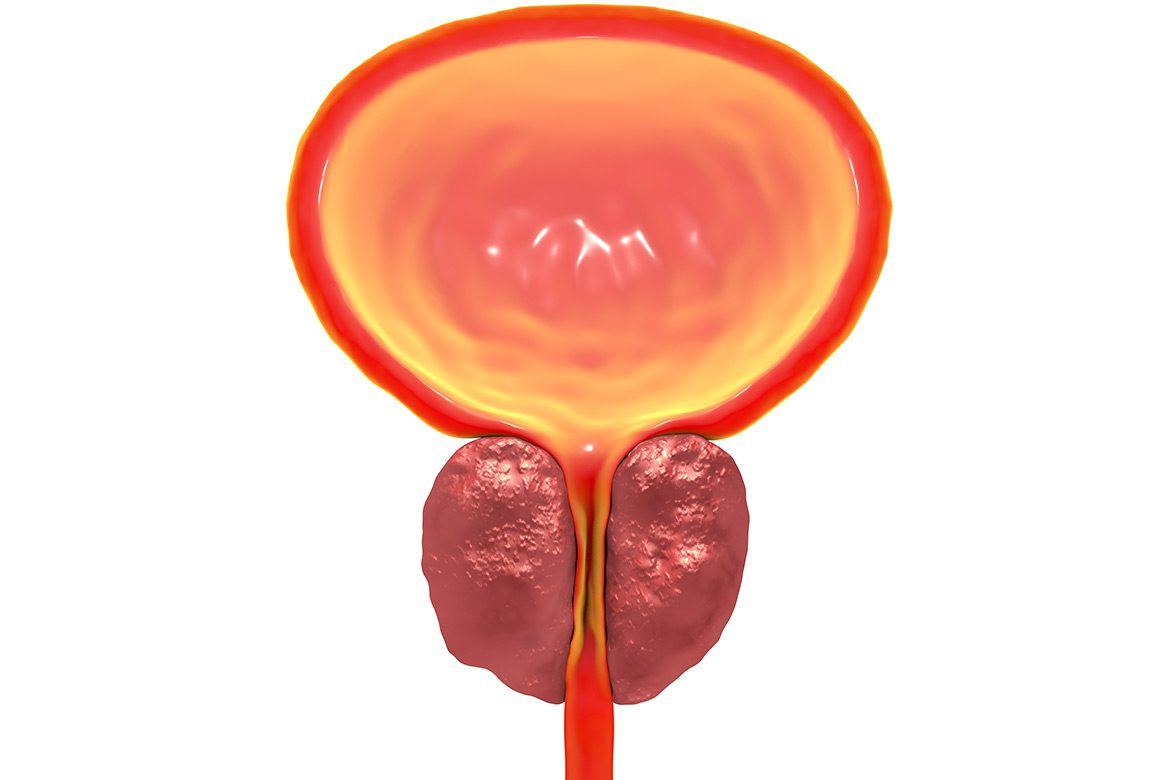 Enlarged-Prostate-Diagram