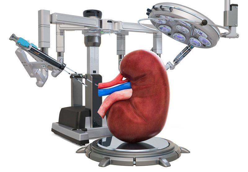 3D-rendering-of-robotic-kidney-surgery-procedure