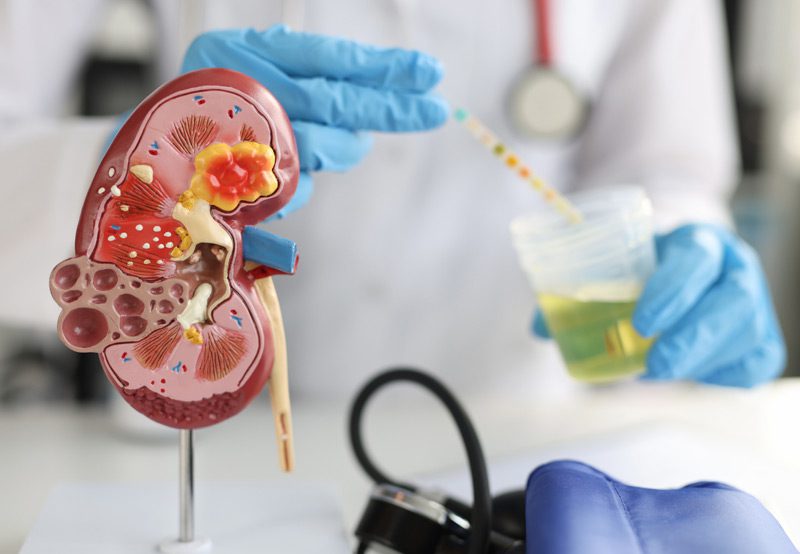Artificial-kidney-and-ureter-model-on-doctor’s-table