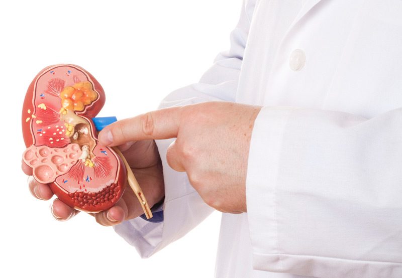 Image-of-doctor-holding-kidney-model Image-of-doctor-holding-kidney-model