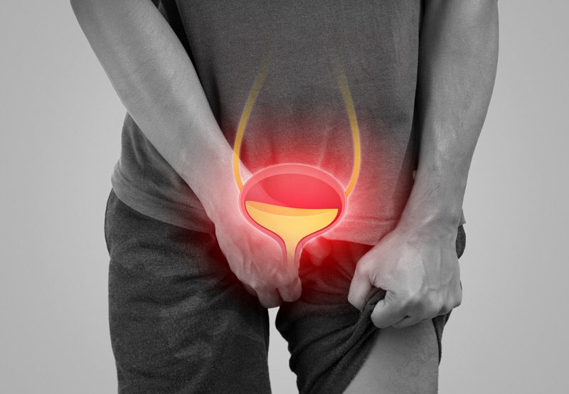 Image-representing-urinary-hesitancy-symptoms-in-patients