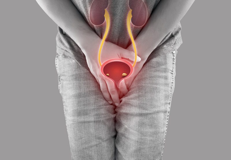 Male-with-pain-from-bladder-stones