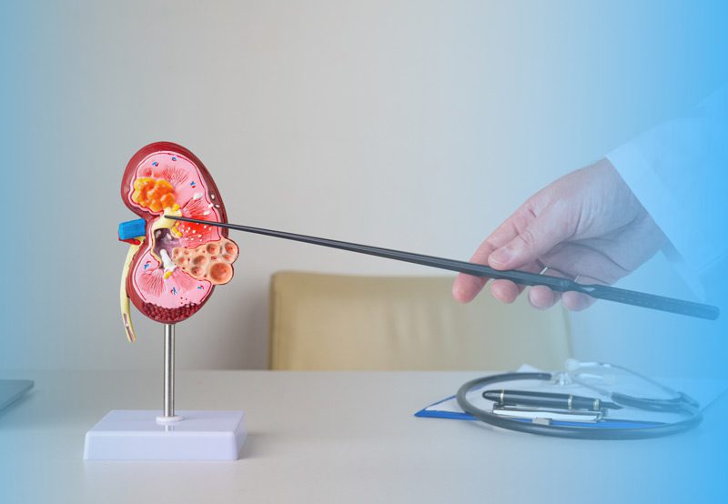 Nephrologist-examining-renal-sinus-fat-on-kidney-mockup