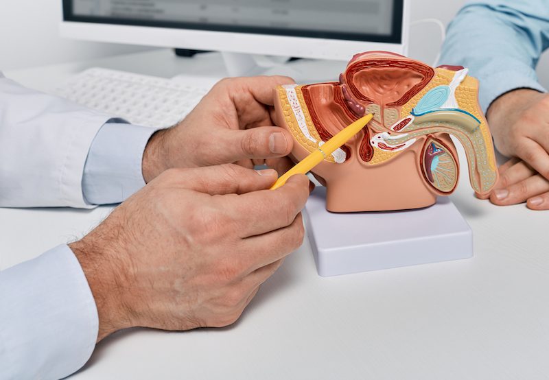 doctor pointing to model of prostate and urinary system doctor pointing to model of prostate and urinary system