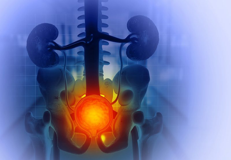 illustration of enlarged prostate anatomy