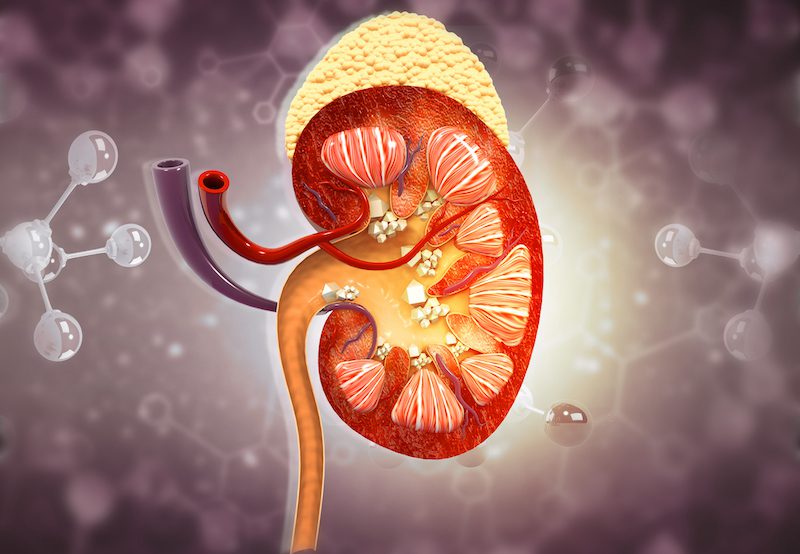 illustration of kidney cross section with stones
