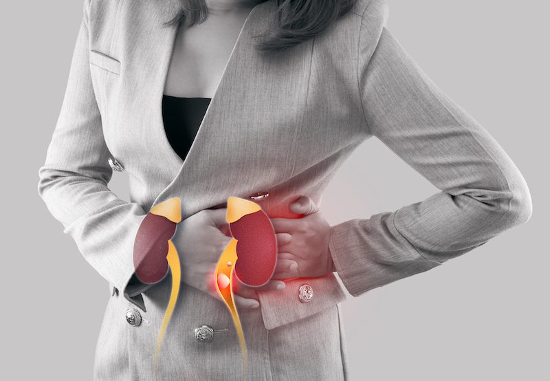 woman experiencing pain from ureter stone